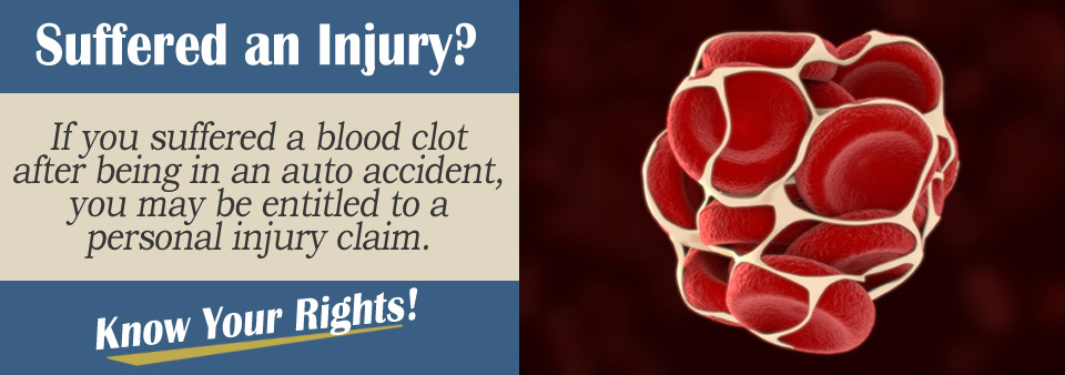 Blood Clot Caused by a Merging Accident