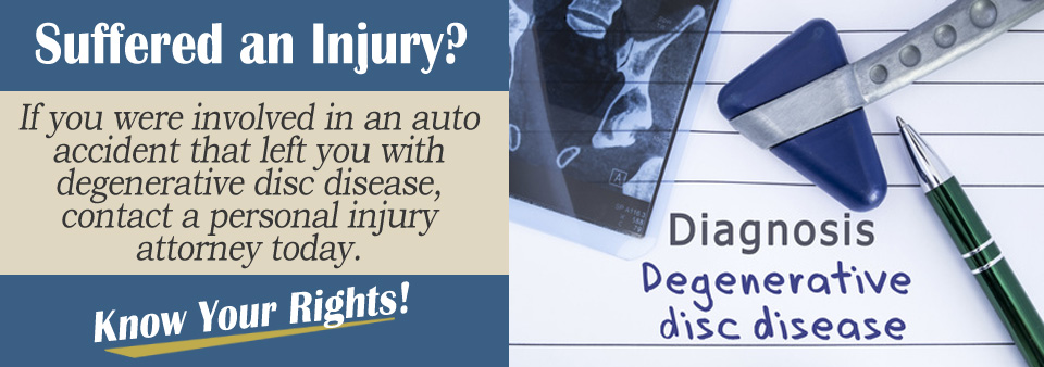 Can Auto Accidents Cause Degenerative Disc Disease?